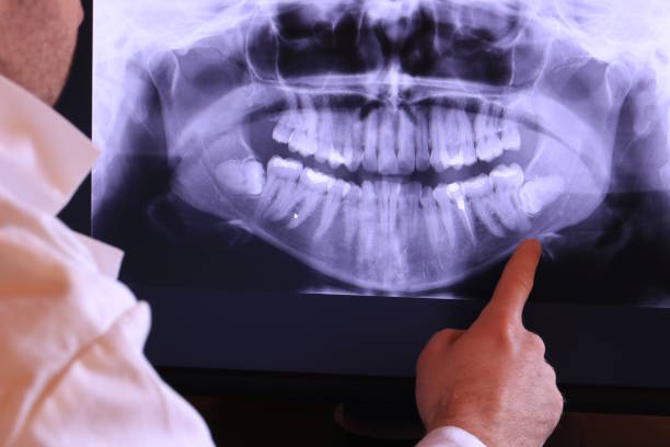 Best Emergency Dental Extractions in La Homa, TX